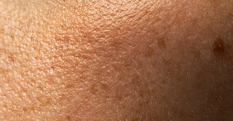 หมองคล้ำ