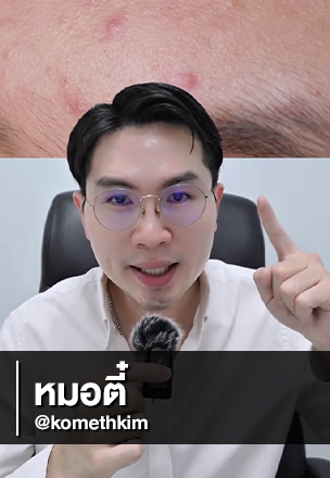 เลือกเซรั่มสิว ต้องดูที่สารสกัด