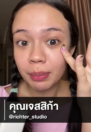 ประสบการณ์สยบสิวแบบเห็นผล..จึ้งมาก!