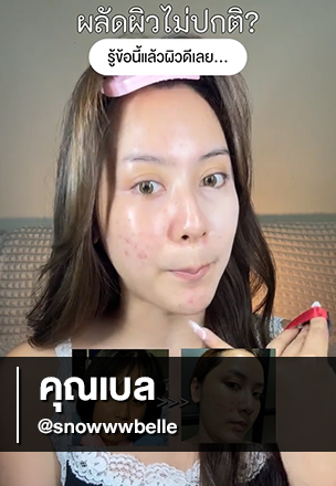 รีวิว Acne Clear Serum